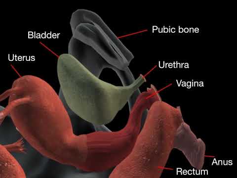 how-to-insert-a-pessary-ring